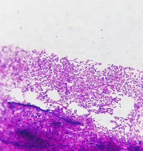 Bakterie zubního hlenu - směs bakterií